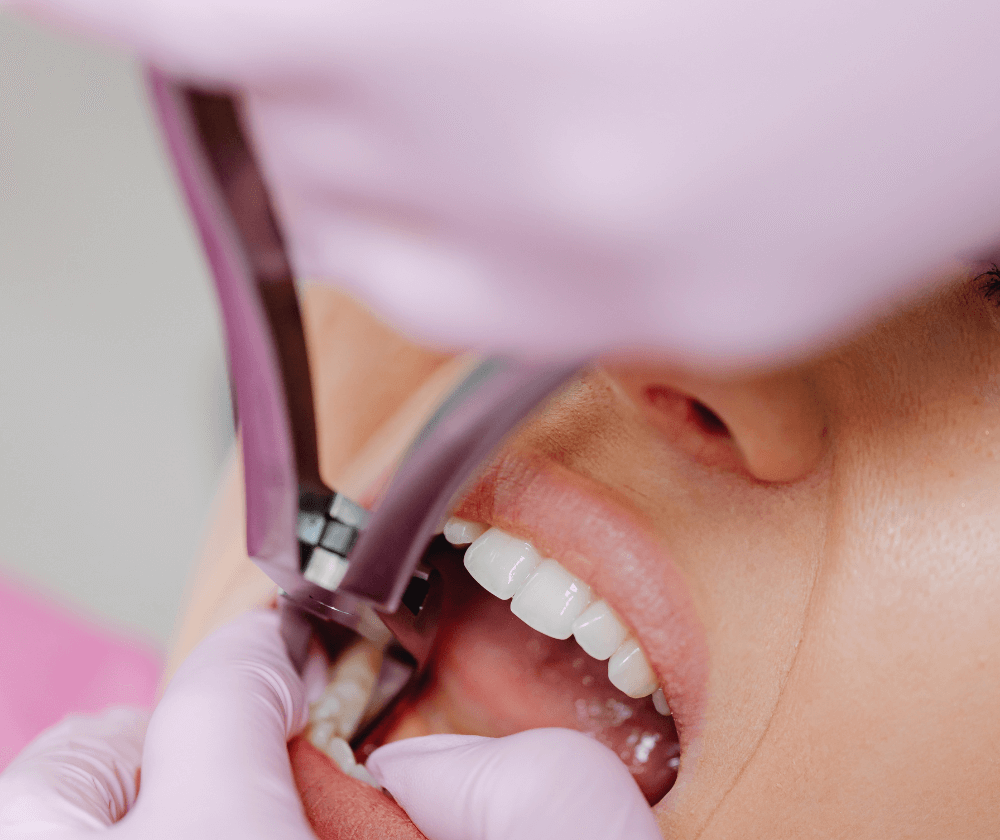 How-does-the-teeth-in-a-day-procedure work